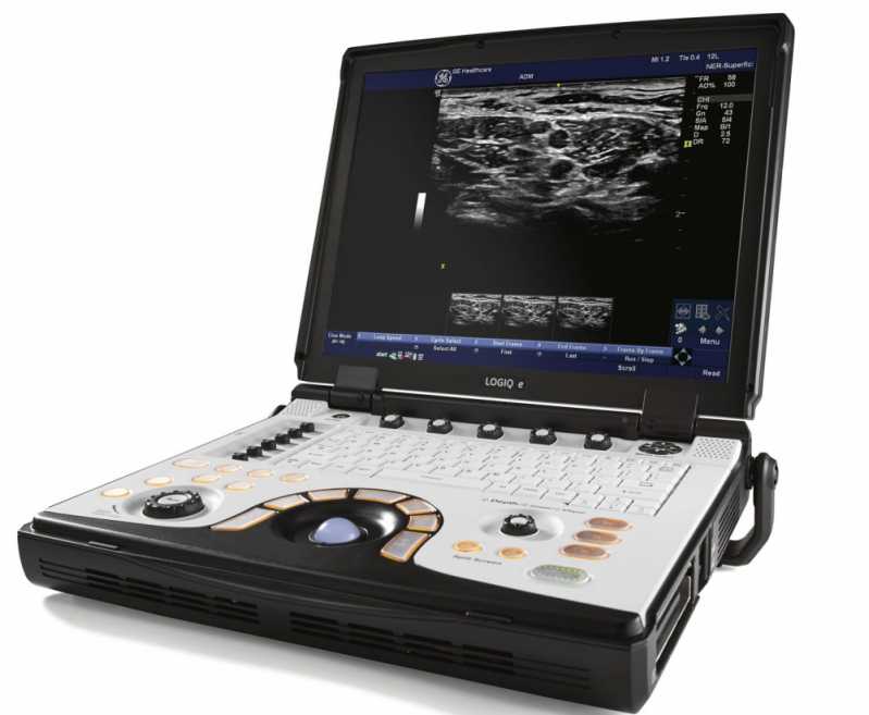 Aparelho de Ultrassonografia Portátil Mambaí - Aparelho Médico de Ultrassom Portátil