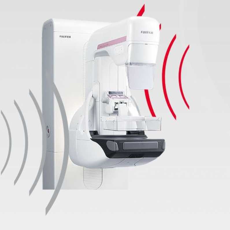 Manutenção de Aparelho de Mamografia Digital Itapira - Manutenção de Equipamento de Mamografia Bilateral